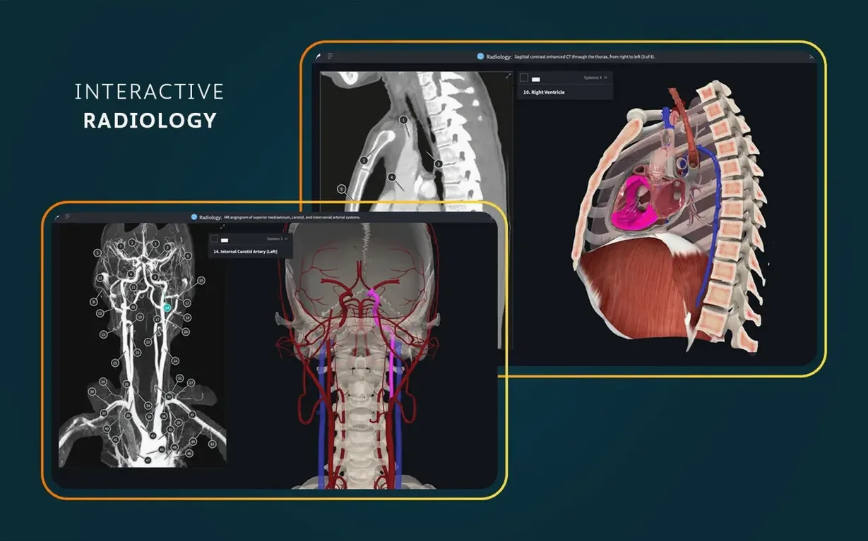 Complete Anatomy image 7 of 8 Screen 7 of Complete Anatomy